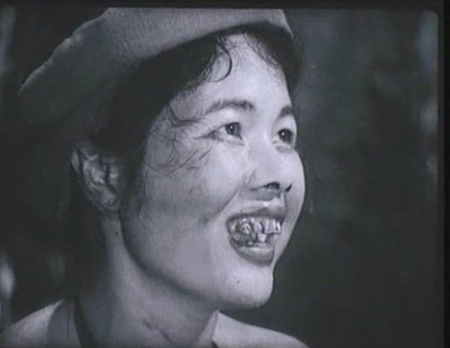 Tạo hình xấu 