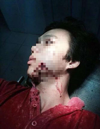 Công an xã bắn lạc đạn cao su trúng mặt người vi phạm giao thông