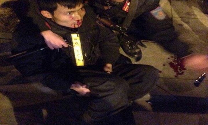 Trải lòng của chiến sỹ CSCĐ bị “quái xế” đâm gãy chân