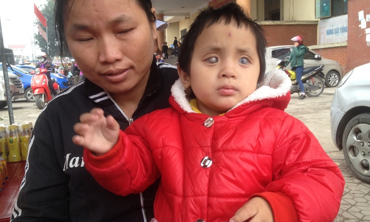 Nỗi lòng người mẹ nghèo nhìn con gái mù lòa trong bất lực