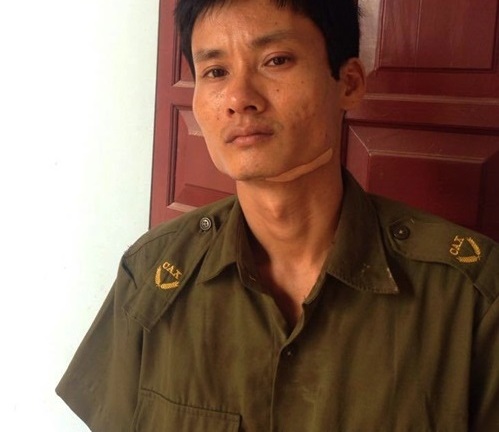 Hải Dương: Công an bị côn đồ đuổi đánh, dí dao vào cổ