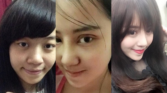 Xôn xao thiếu phụ phẫu thuật thẩm mỹ để giữ chồng