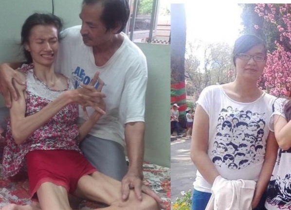 Đau đớn nữ sinh mắc chứng bệnh hiếm gặp, dang dở giấc mơ tới trường