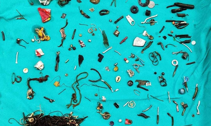 Bệnh nhân nhập viện vì đau dạ dày kéo dài 2 năm, bác sĩ đứng hình khi biết nguyên nhân