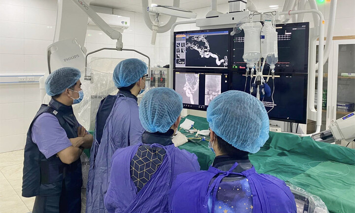 Người đàn ông suýt tử vong do vỡ túi phình mạch máu