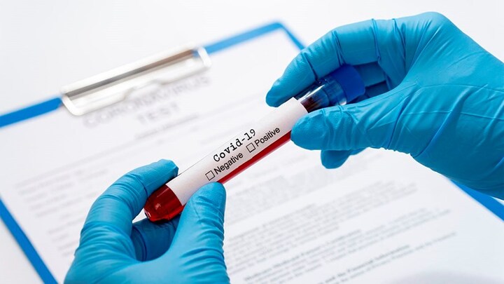 TP.HCM: 86% ca mắc COVID-19 đều thuộc nhóm nguy cơ 