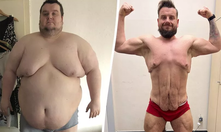 Hành trình giảm 160kg, thay đổi ngoạn mục của người đàn ông