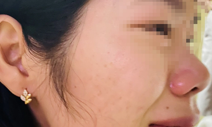 Không bằng lòng về việc con bị hạ hạnh kiểm, phụ huynh đến nhà hành hung cô giáo