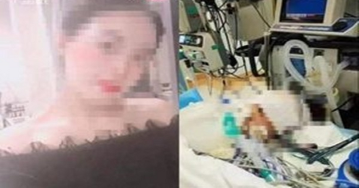 Ham mê thẩm mỹ làm đẹp cô gái tử vong chỉ vì điều này