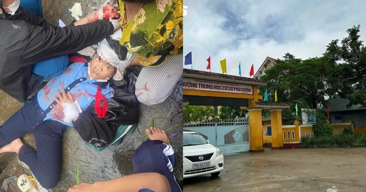 Tình hình sức khỏe của nữ sinh lớp 6 bị gã thanh niên dùng búa đánh vào đầu