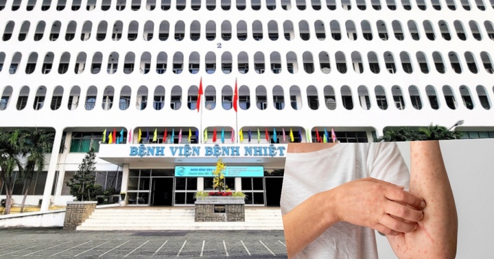 TP Hồ Chí Minh: Ghi nhận ca tử vong đầu tiên có liên quan đến bệnh đậu mùa khỉ 