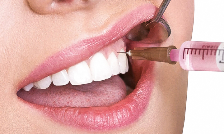 Đi chữa đau răng, người đàn ông phải nhập viện cấp cứu sau khi tiêm thuốc tê