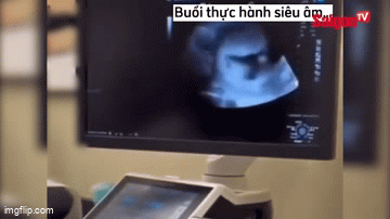 Chuyện lạ trường Y: Sinh viên đang thực hành siêu âm cho nhau thì phát hiện 2 người mang thai, chính chủ cũng phải “mắt chữ O mồm chữ A”