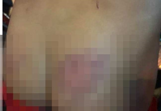 Vụ học sinh lớp 2 bị đánh tím mông ở Đà Lạt: Cô giáo không được phân công giảng dạy ít nhất 6 tháng