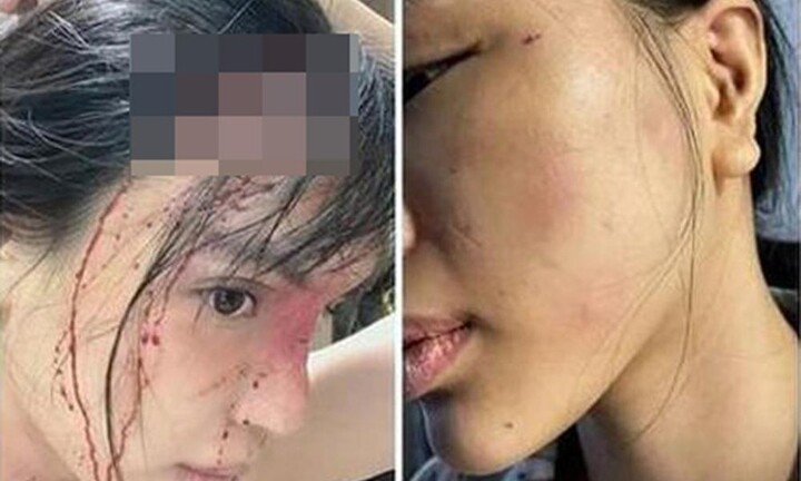 Tin tức pháp luật ngày 4/12: Công an làm rõ vụ siêu mẫu Khả Trang tố bị bạn trai hành hung