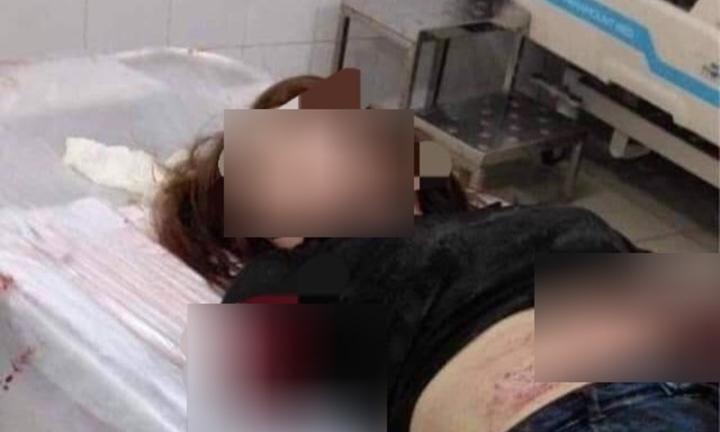 Sức khỏe người vợ bị chồng chém đứt 2 cánh hiện ra sao?