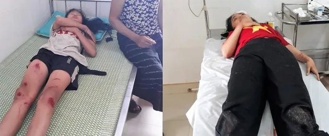 3 học sinh thương vong vì xe đạp điện mất lái lao xuống suối