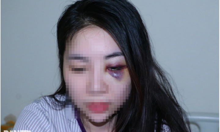 Vụ người đàn ông cầm ghế đánh tới tấp vào đầu cô gái: Lời kể người trong cuộc