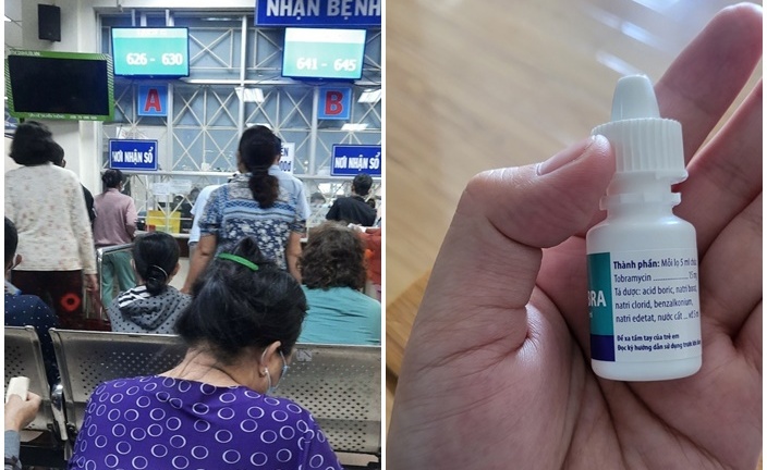 Xôn xao thông tin đau mắt đỏ lây qua đường nước uống: Sở Y tế TP.HCM lên tiếng