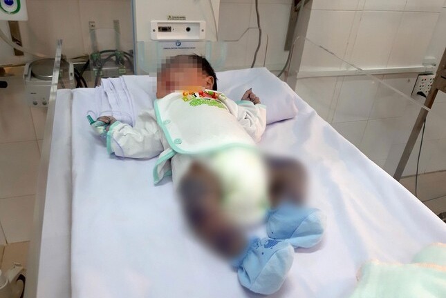 Tin tức đời sống ngày 10/6: Cứu sống bé trai 13 ngày tuổi bị thủy đậu toàn thân