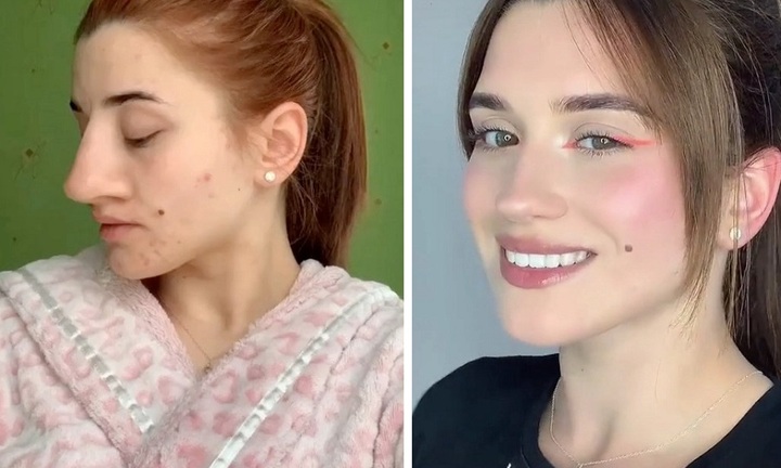 Cô nàng khoe video “vịt hóa thiên nga” nhờ sửa mũi, dân mạng tìm ra ngay điểm bất thường