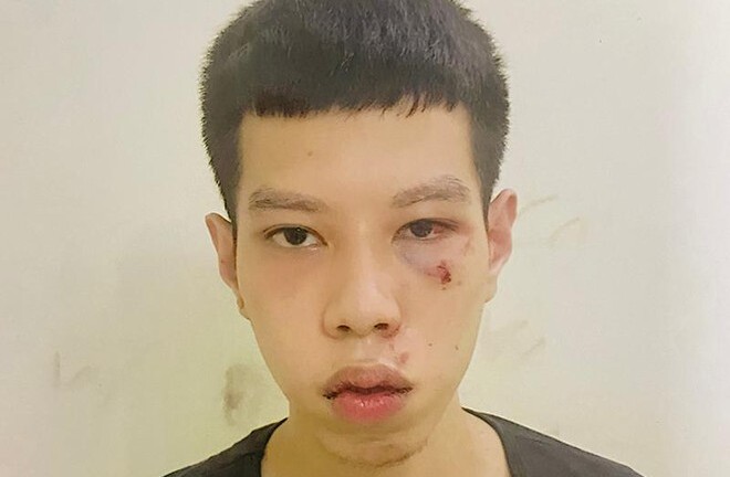 Bắt giữ đối tượng cướp 16 triệu đồng tiền lương hưu của cụ bà 70 tuổi