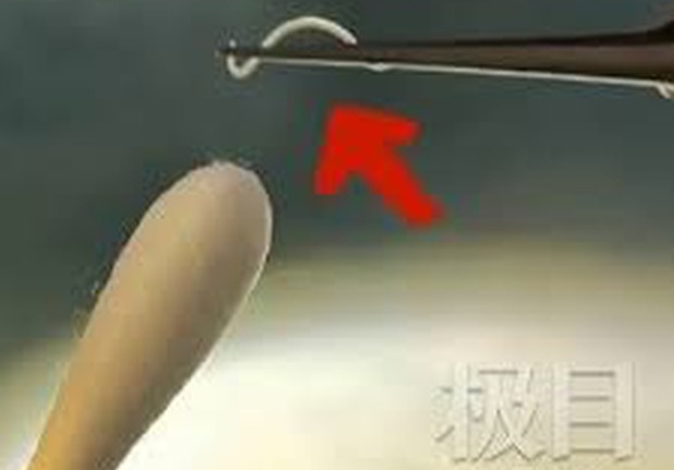 Tin tức đời sống ngày 14/8: Hãi hùng bé trai 2 tuổi bị 6 con sán làm tổ trong hốc mắt