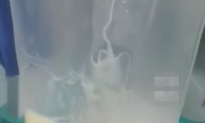 Chàng trai 24 tuổi đau bụng phải đi viện, máu chuyển màu trắng đục vì thói quen nhiều người mắc