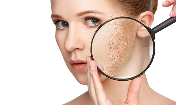 Điểm mặt 4 sai lầm khiến da nứt nẻ, khô ráp đáng sợ vào mùa đông