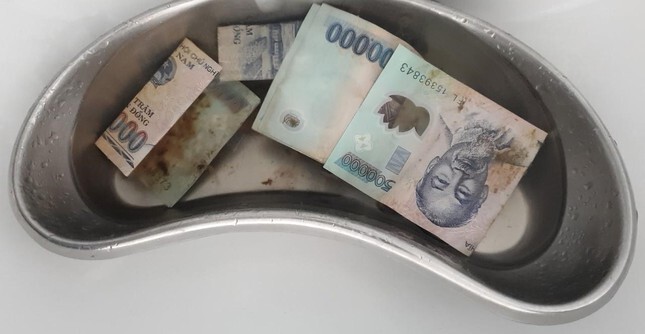 Tin tức đời sống ngày 31/1: Phẫu thuật gắp gần 13 triệu đồng trong bụng người phụ nữ