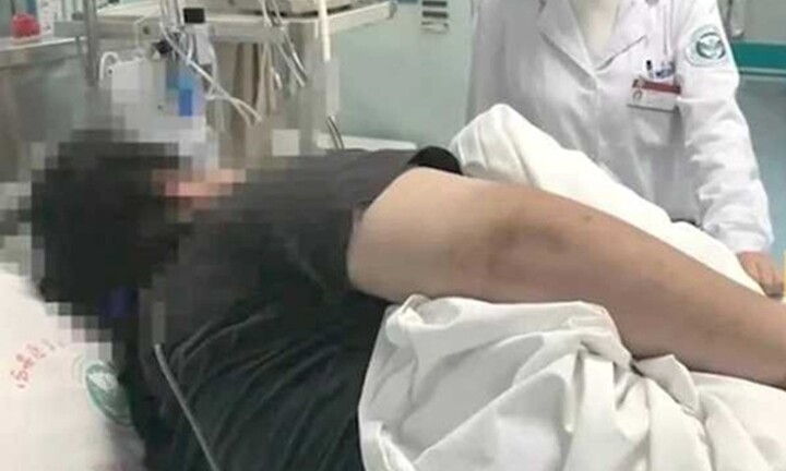 Người đàn ông chỉ ăn 1 bữa mỗi ngày nhưng nặng tới 130kg, nguyên nhân gây choáng váng