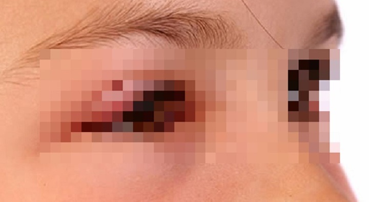 Tin tức đời sống ngày 15/3: Bác sĩ phát hiện cả ổ giun bên trong mắt bé gái 2 tuổi