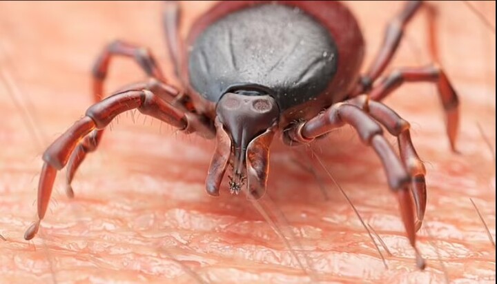 Người đàn ông nhiễm virus cực hiếm gặp sau khi bị bọ ve cắn