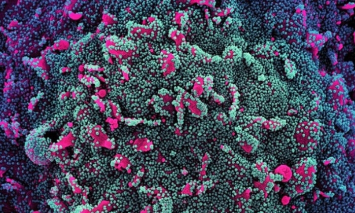 Người nhiễm biến thể BA.5 có những triệu chứng nào?