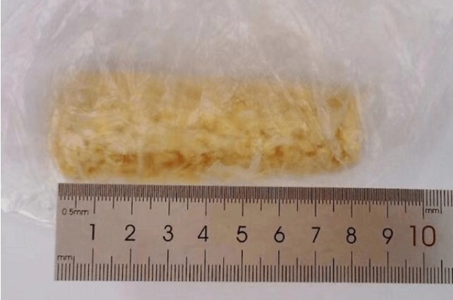 Bé 8 tháng tuổi bị thương do lõi ngô rơi trúng đầu khi đang ở dưới sân chung cư