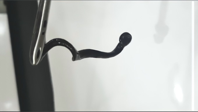 Bé trai cảm giác có vật thập thò ở mũi, đi khám mới biết bị vắt ký sinh