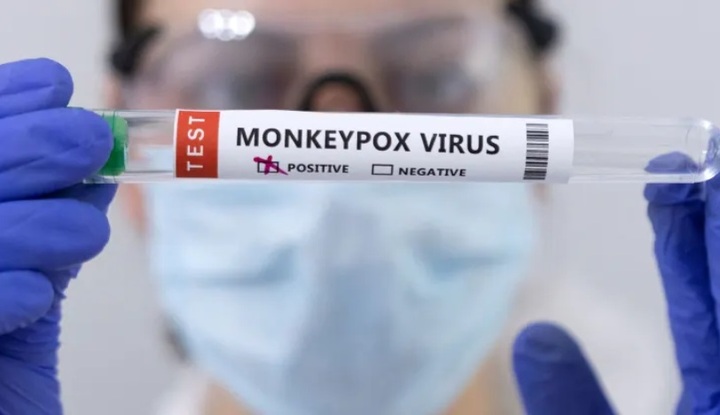 Phát hiện ca nghi lây nhiễm virus gây bệnh đậu mùa khỉ từ người sang chó đầu tiên