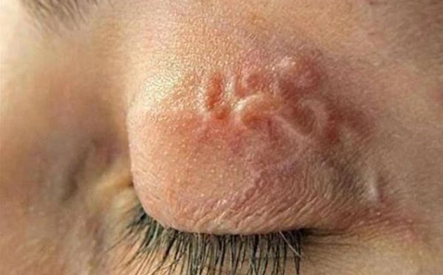 Tin tức đời sống ngày 17/9: Cô gái 29 tuổi chỉ nặng 32kg vì nhiễm giun lươn