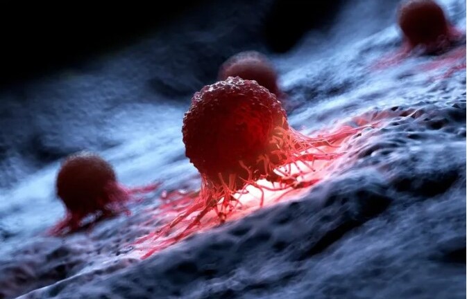 Nghiên cứu chỉ ra hoạt động có thể giúp giảm 72% nguy cơ ung thư di căn