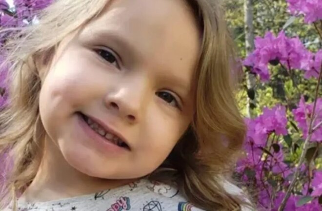 Bé gái 6 tuổi phải khâu 1.000 mũi, không thể cười trở lại vì bị chó pitbull tấn công