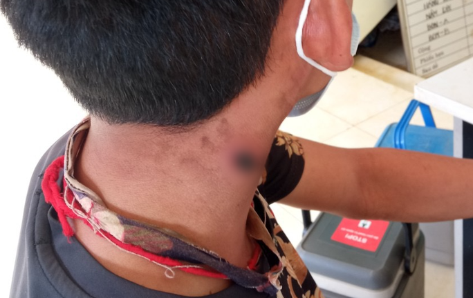 Tin tức đời sống ngày 6/6: Điện Biên ghi nhận thêm 1 ca mắc bệnh than