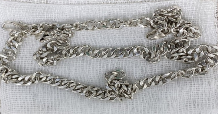 Tin tức đời sống ngày 11/7: Cứu bé gái 6 tuổi nuốt sợi dây chuyền dài vào bụng