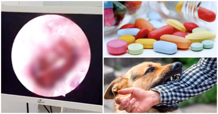 Tin tức đời sống mới nhất ngày 12/8: Đi khám vì lỗ tai chảy máu, người phụ nữ phát hiện điều đáng sợ