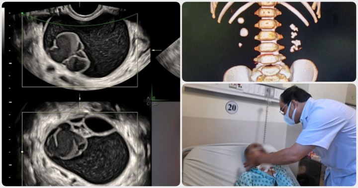 Tin tức đời sống mới nhất ngày 13/8: Người phụ nữ có khối u buồng trứng to như thai 28 tuần