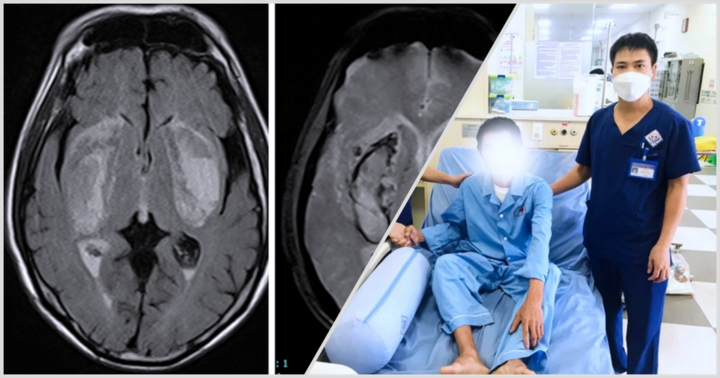 Tin tức đời sống mới nhất ngày 17/8: Mất thị lực, nguy cơ sống thực vật sau khi uống cồn pha nước lọc