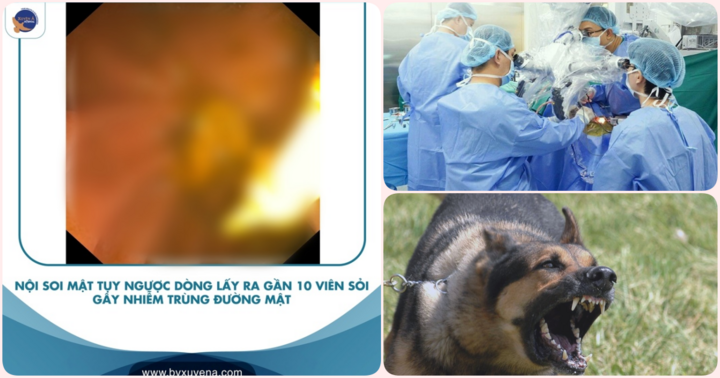 Tin tức đời sống mới nhất ngày 24/8: Người đàn ông không nhai được, chỉ húp cháo suốt 4 năm