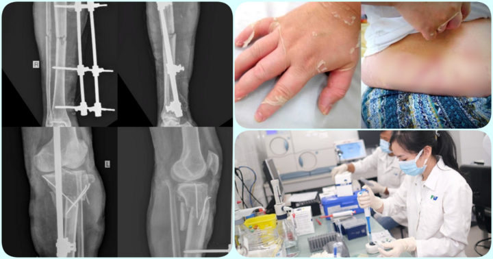 Tin tức đời sống mới nhất ngày 26/8: Lạm dụng thuốc xịt mũi, 2 anh em ruột bị suy thượng thận