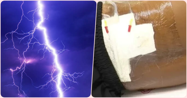 Người đàn ông may mắn sống sót sau khi bị sét đánh 2 lần liên tiếp