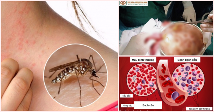 Tin tức đời sống mới nhất ngày 1/9: Phát hiện hơn trăm con giun đũa trong bụng bé 64 tháng tuổi