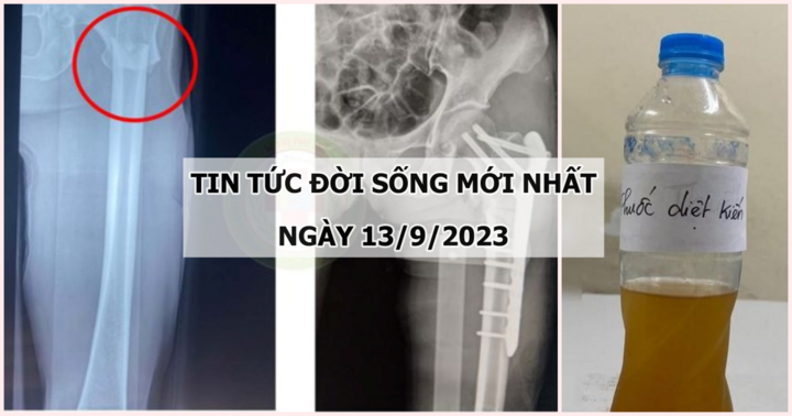 Tin tức đời sống mới nhất ngày 13/9: Người phụ nữ mất vận động chân trái sau khi bị trâu tấn công